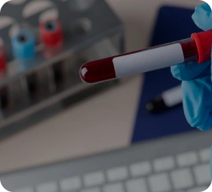 Blood Tests
