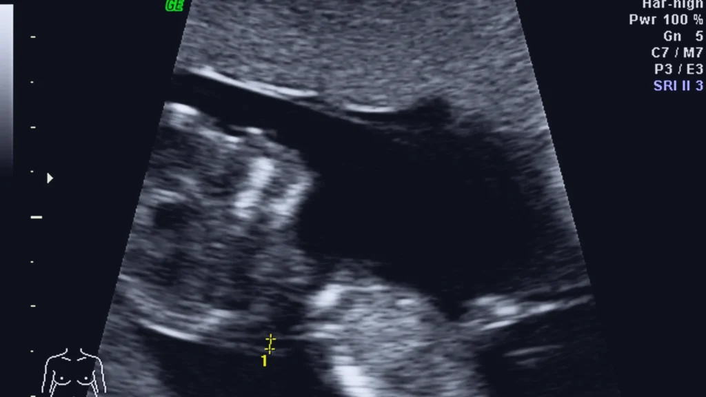 Pregnancy ultrasound showing safe monitoring of fetal development at a private GP clinic